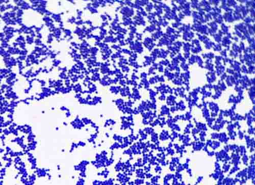staphylococcus aureus gram stain 100x