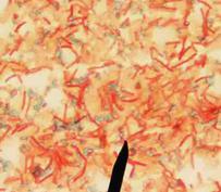 Endospore stain showing endospores (green) and vegetative cells (red) 1000xTM.