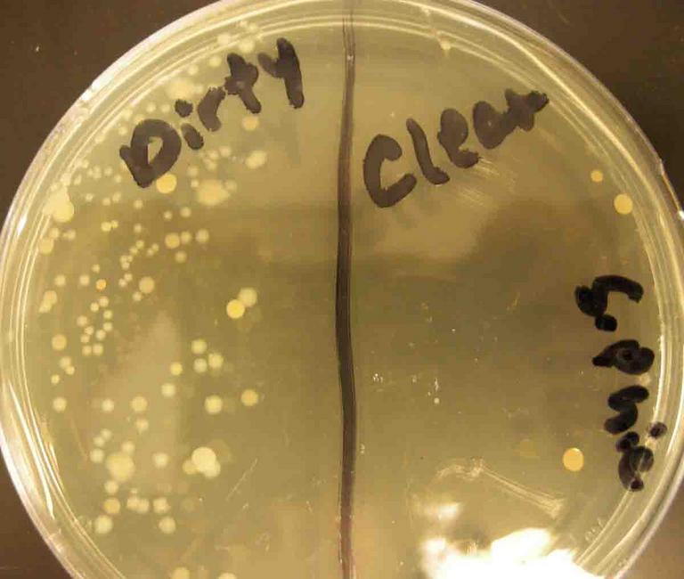 TSY Media Growing Bacterial Samples from a Dirty and a Clean Dishwash