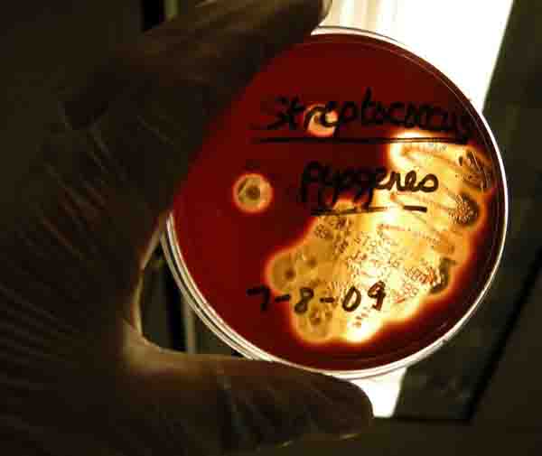 Blood Agar with S. pyogenes Beta Hemolysis