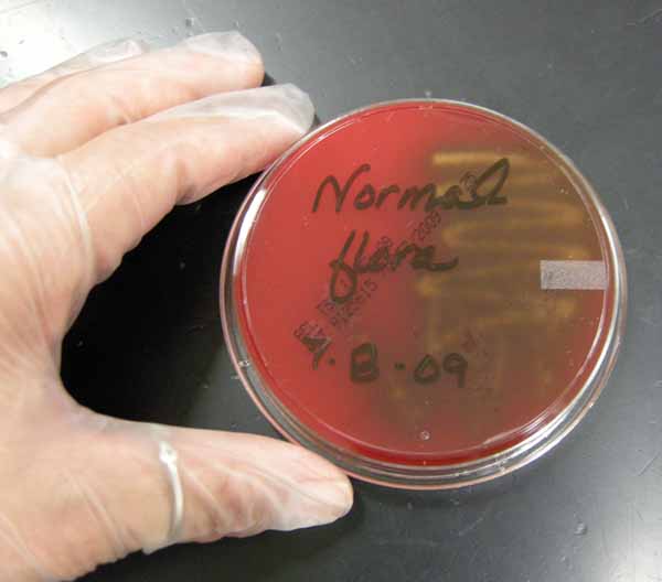 Blood agar showing Alpha-hemolysis, which indicates normal flora