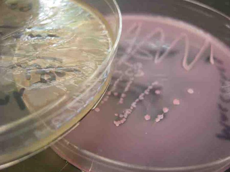 MacConkey's Agar Growing Gram-negative Bacteria: Lactose Fermenter on Right, Non-lactose Fermenter on Left.