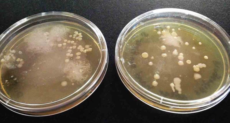 Touch plates of bacteria on fingertips: Left plate dirty hands, right plate after alcohol-based hand sanitizer..