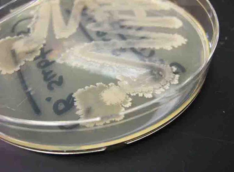 ​ Bacillus subtilis  bacterial colonies grown on TSY agar