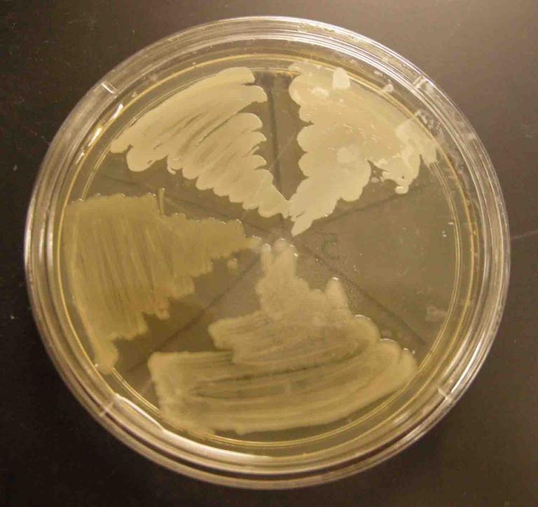 TSY Agar inoculated with the following control samples (clockwise from top left): Staph aureus, Staph epi, sterile loop, Salmonella, E. coli.