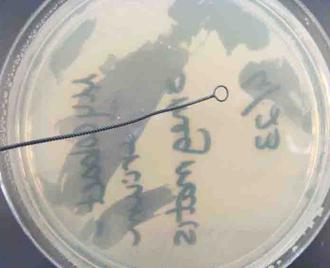 Loop Being Used to Inoculate the Solid Surface of Tryptic Soy Agar in a Petri Dish.