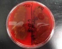 Alpha Hemolysis on Blood Agar, Indicating Normal Flora