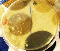 The Shark Ligth & Easy Steam Mop experiment was repeated and the samples plated on a plate of TSY agar. The "before cleaning" floor sample is on the left (note numerous bacterial colonies) and the "after" cleaning sample on right.