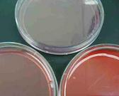 MacConkey's Agar, Blood Agar & Mannitol Salt  Agar(clockwise from top)